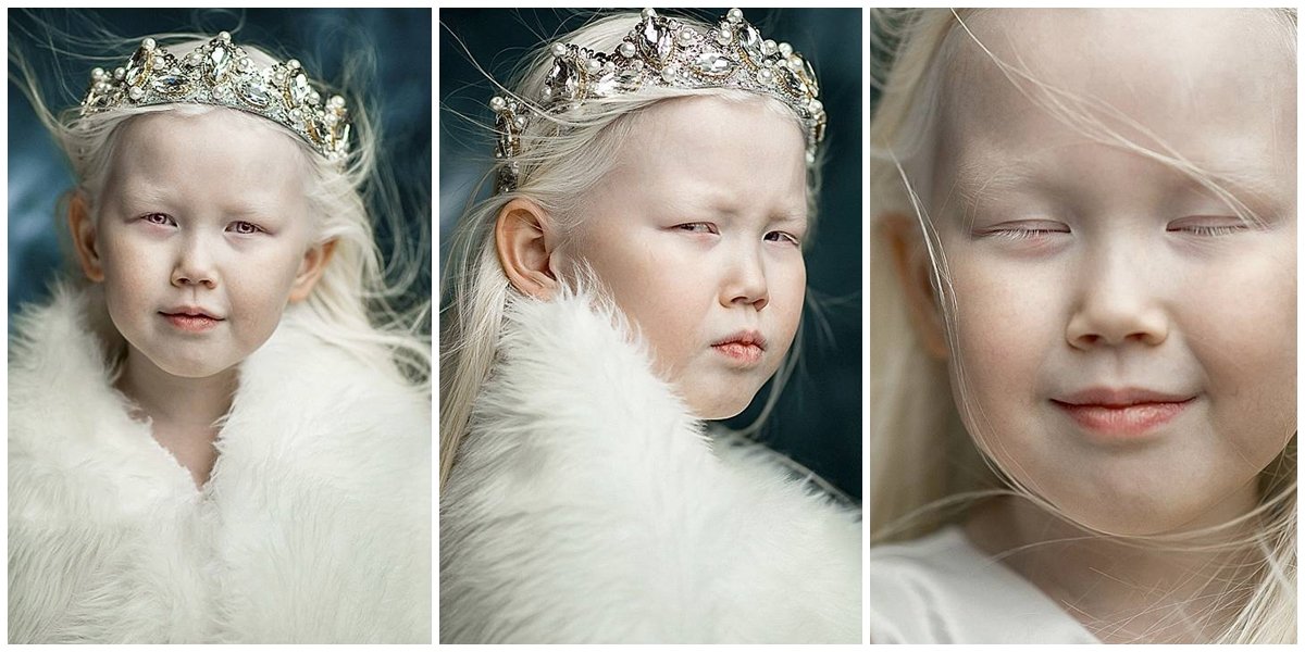 This 8-Year-Old With Looks Of A Fairy Princess Rocks The Modeling World, Flooded With Offers