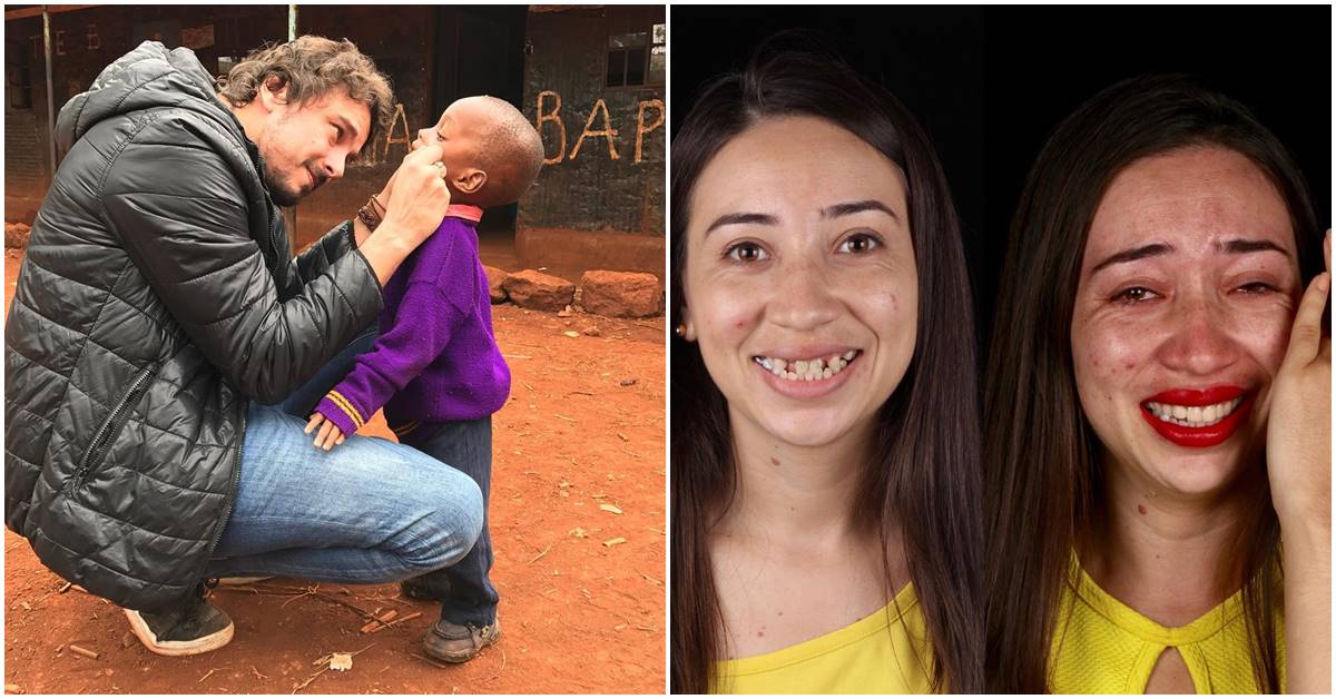 Brazilian Dentist Puts Beautiful Smiles Back On The Faces Of The Underprivileged